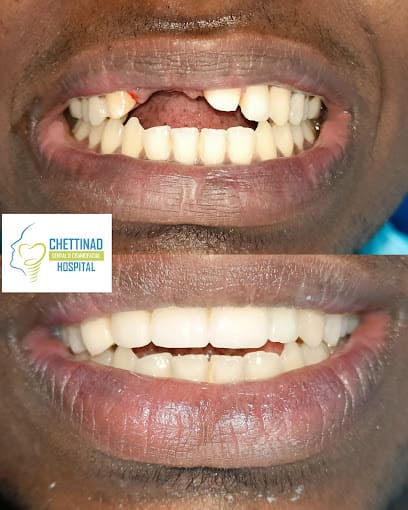 Teeth whitening in karaikudi